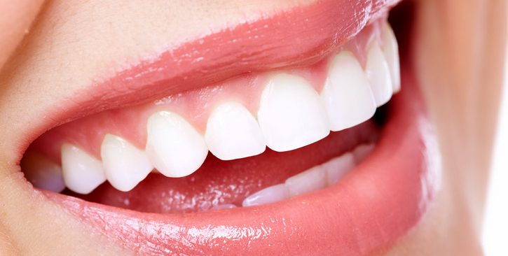 5 nem invazív otthoni kezelés a szuper fehér fogakért
